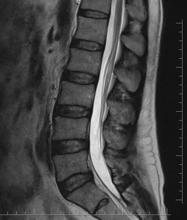 Case of the Week 14 2017 - Radiology Case Cafe