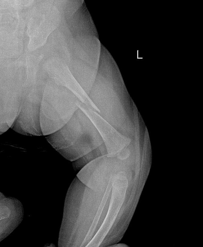 case-of-the-week-26-2017-radiology-case-cafe