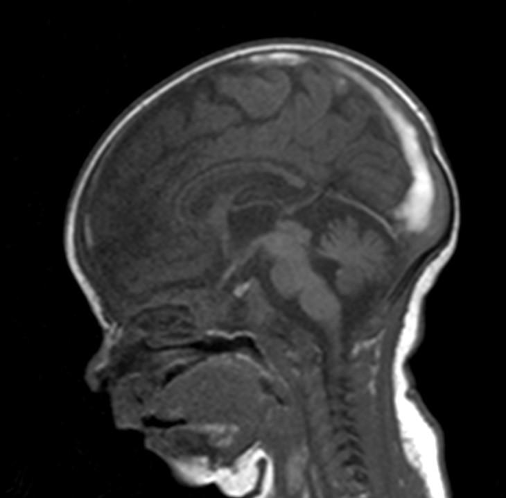 case-of-the-week-2-2016-radiology-case-cafe