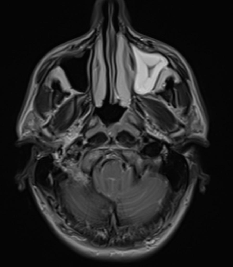 Case of the Week 36 2017 - Radiology Case Cafe