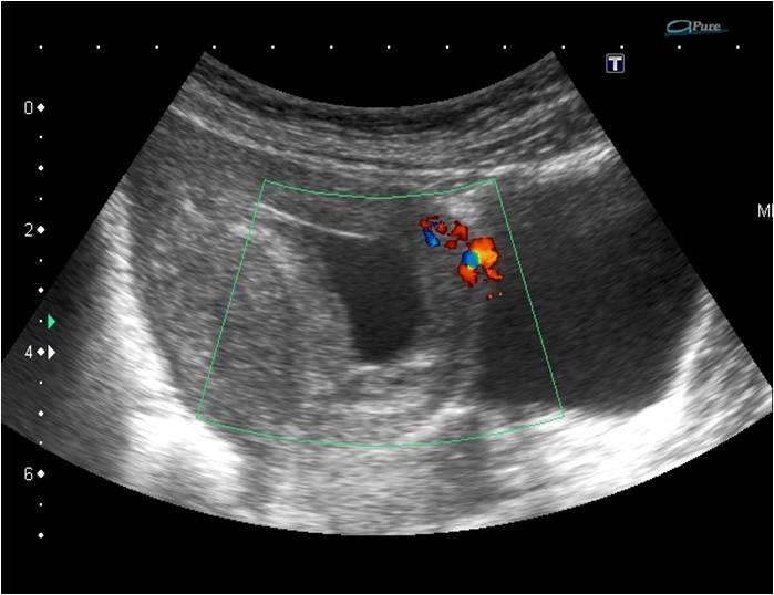 Case of the Week 17 2015 - Radiology Case Cafe